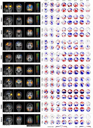 The left row shows sagittal, coronal and horizontal slices of the ten RSNs (p<0.005; corrected at α<0.05 / x, y & z coordinates are provided at the left bottom corner of each RSN). On the right side the covariance and t-maps for the 8 frequency bands are displayed. A positive covariance value (red) indicates that with increasing RSN activity there is a relative increase in spectral power at a given electrode in a given frequency band, while a negative value (blue) indicates a decrease in power when the RSN activity increases, and vice versa.