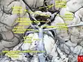 Circle of Willis