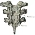 Vertebral arches of three thoracic vertebrae