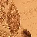 Schistosoma intercalatum