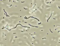 Streptococcus iniae, a Gram-positive, sphere-shaped bacteria caused losses in farmed marine and freshwater finfish of US$100 million in 1997.